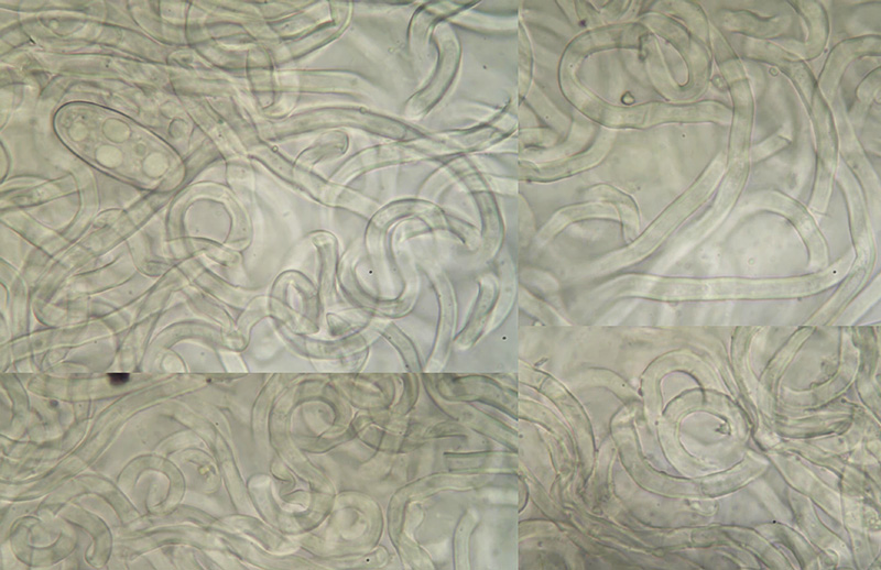 Sarcoscypha austriaca chloupky Sarcoscypha austriaca hairs